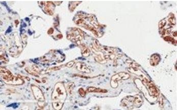 PIK3C2A Antibody