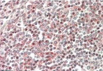 CD2BP2 (N Terminus) Antibody
