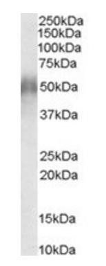 CD2BP2 (N Terminus) Antibody