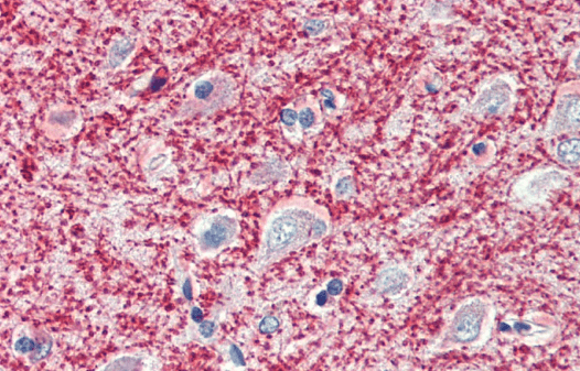 MOG Antibody