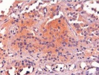 Goat anti-Proopiomelanocortin / POMC Antibody
