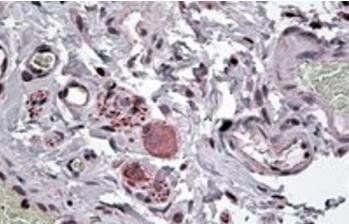 Neuropeptide Y receptor Y5 Antibody