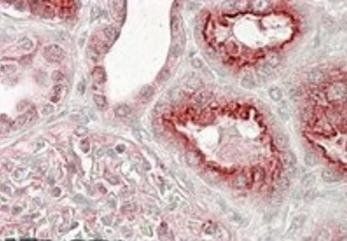 VPS11 Antibody
