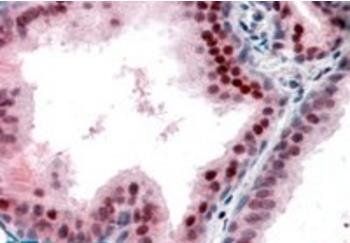 P27KIP1/CDKN1B (internal) Antibody