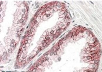Catenin alpha1 Antibody