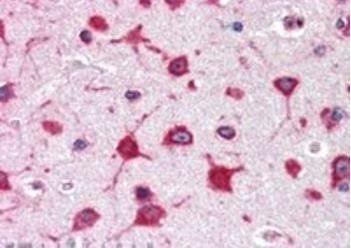 ribosomal protein L8 Antibody