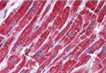 Fumarase/FH Antibody