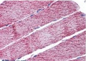 Fumarase/FH Antibody