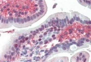 EGR2 Antibody