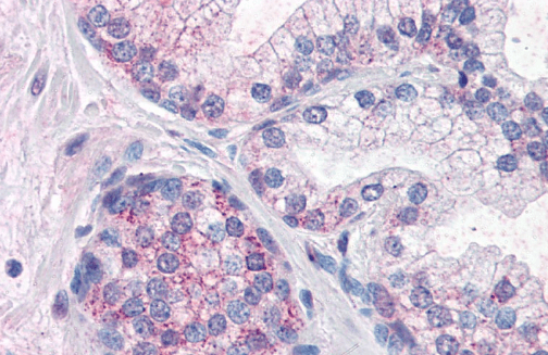 PDE11A Antibody