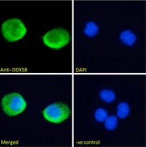 DDX58 Antibody