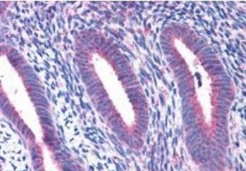 Ribosomal protein L22 Antibody