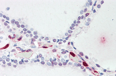 ATP13A1 Antibody