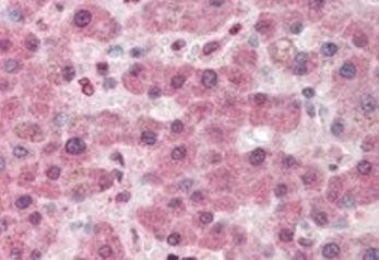 Pyruvate Carboxylase Antibody