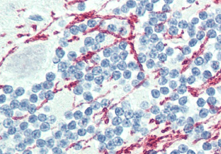 GCH1 Antibody