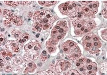 KPNA6 Antibody