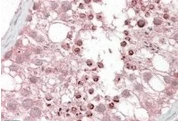 USP28 Antibody