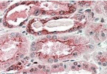 GGCX Antibody