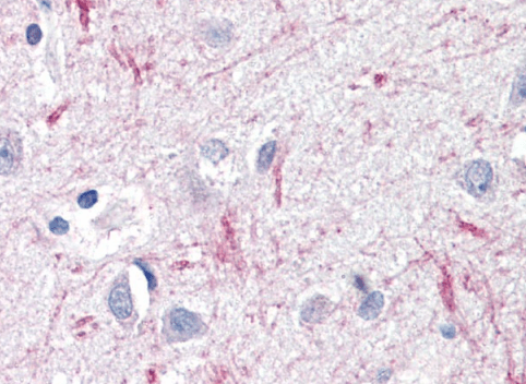 DTX3 Antibody