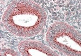 SNX1 Antibody