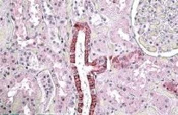 TGFBI Antibody