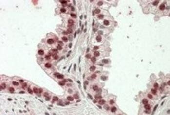 HOXD13 Antibody