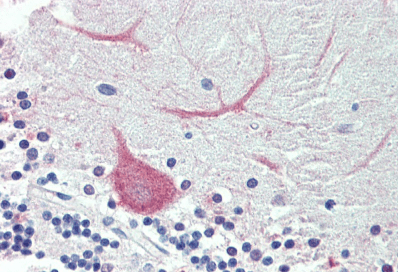 TRIM71 (aa390-402) Antibody