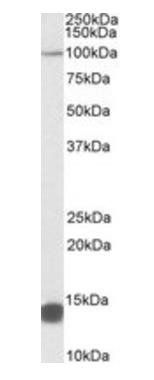 TRIM71 (aa409-419) Antibody