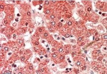 ALDH6A1 (aa487-496) Antibody