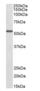 ALDH6A1 (aa487-496), Biotinylated Antibody