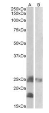 DCTN3 Antibody