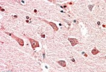 MYO1B Antibody