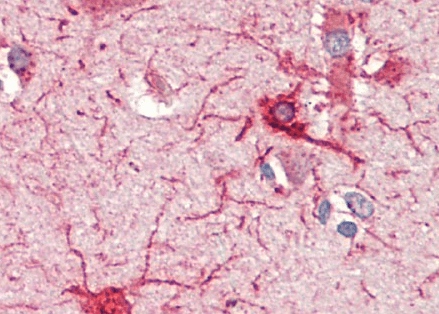 Crot (rat) (aa178-199) Antibody