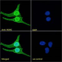 RORC (aa200-212) Antibody