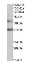 CBARA1 (aa113-126) Antibody