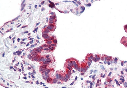CBARA1 (aa113-126) Antibody