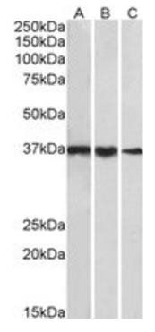 HMHA1 (aa57-71) Antibody