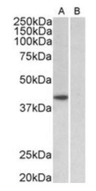 HMHA1 (aa57-71) Antibody