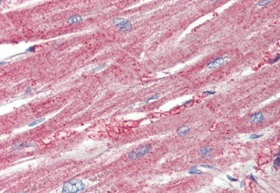 ARPC1A Antibody