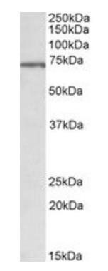 Goat anti-MLC1 (aa179-193) Antibody