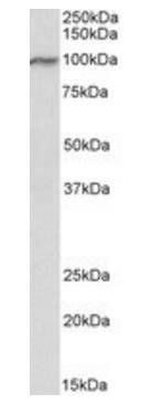 VPS16 (isoform 1) Antibody