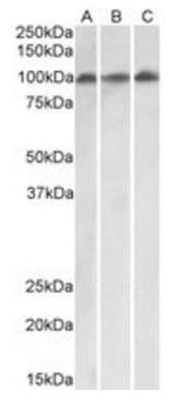 VPS16 (isoform 1) Antibody