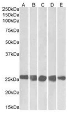 CSNK2B (aa172-186) Antibody