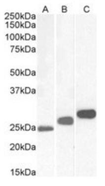 CSNK2B Antibody