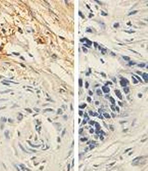 EBAG9 Rabbit Polyclonal Antibody