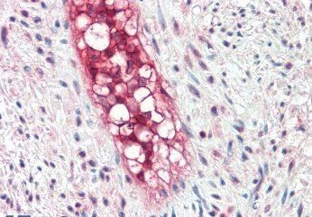 Goat anti-ECSM2 Antibody