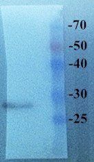 EGFP Rabbit Polyclonal Antibody
