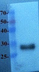 EGFP Rabbit Polyclonal Antibody