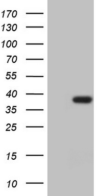 EGFR Antibody