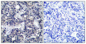 EIF2AK2 Antibody
